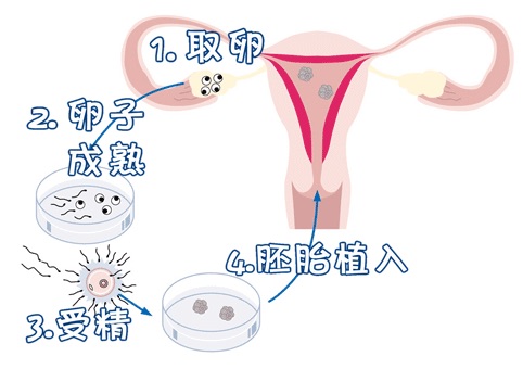 光愈生殖医学中心